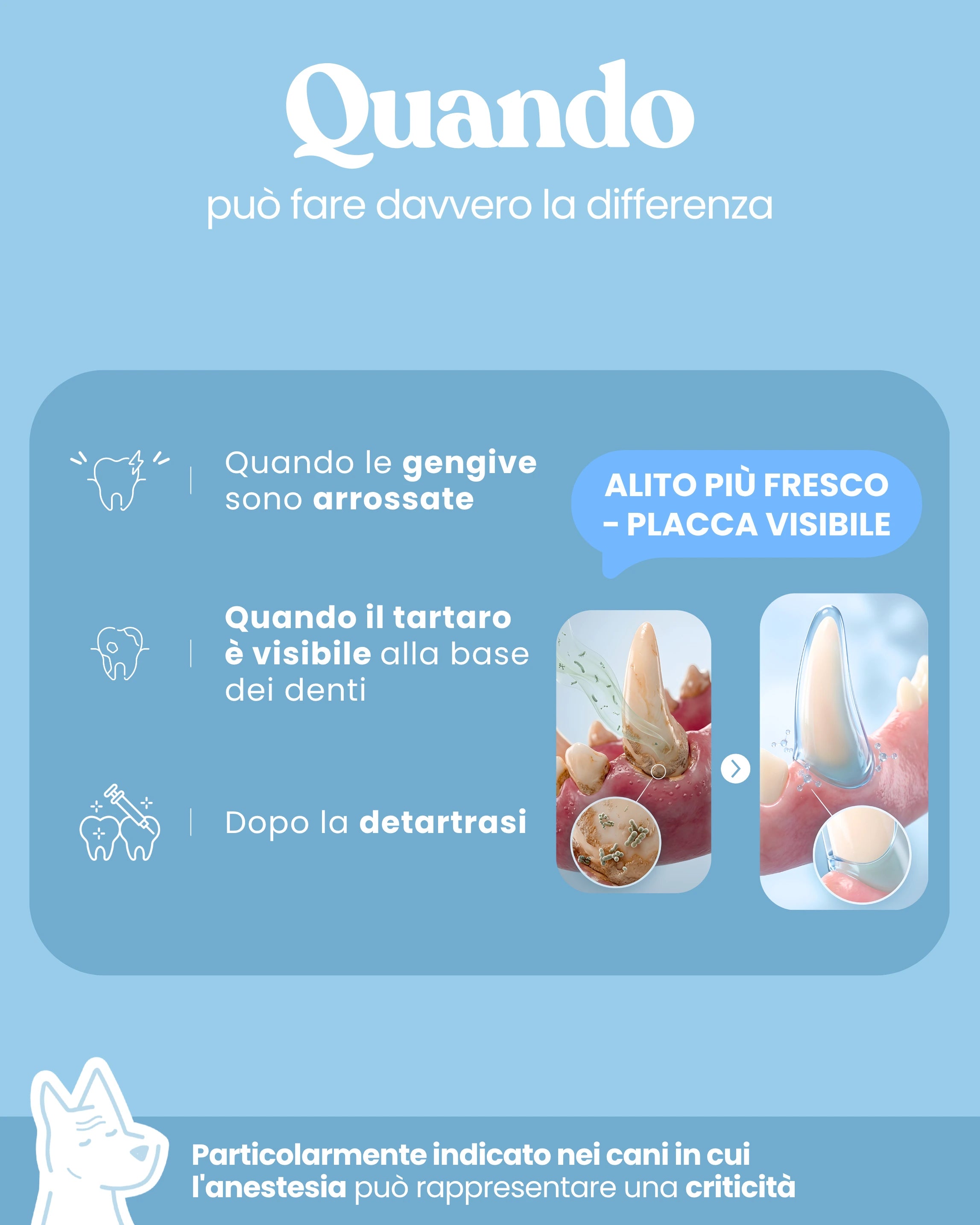 Placca e Tartaro